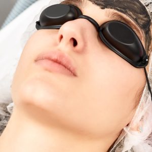 1726 nm Lasers for the Treatment of Acne Vulgaris