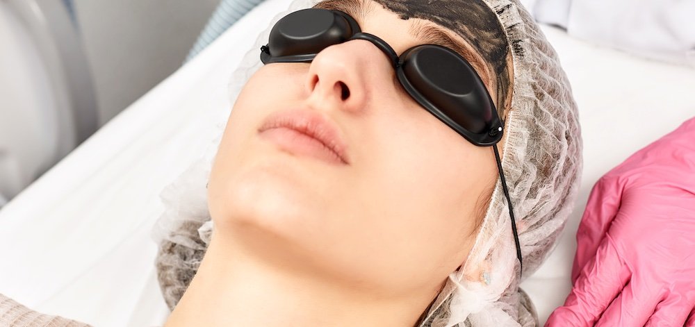 1726 nm Lasers for the Treatment of Acne Vulgaris