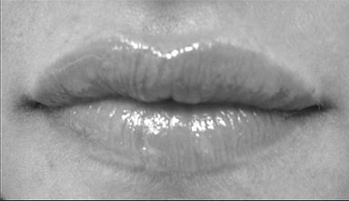 Rejuvenation of the Lip with Injectables - image