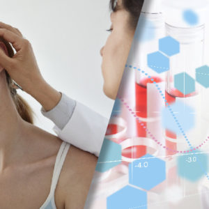 Afamelanotide in the Treatment of Dermatologic Disease