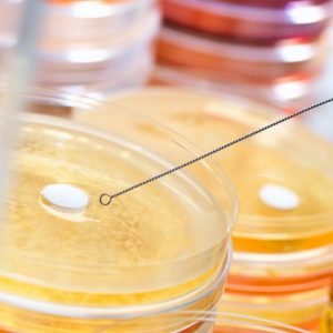 image of medical research being done on antibiotic culture in the lab