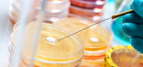 image of medical research being done on antibiotic culture in the lab