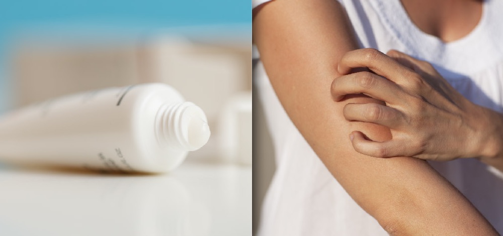 Management and Treatment of Pruritus