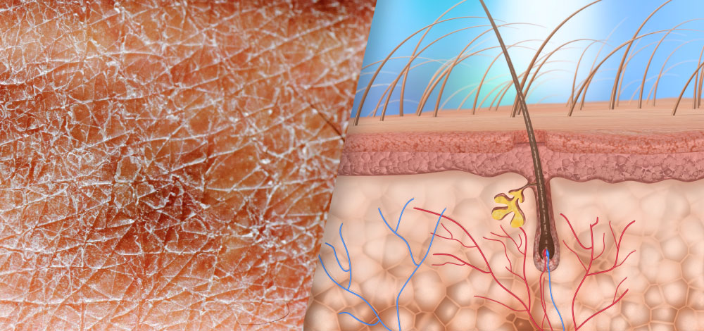 epidermal skin and skin diagram