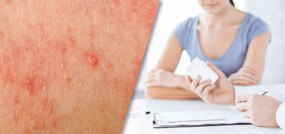 Atopic Dermatitis: Pediatric Use of Crisaborole