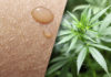 The Therapeutic Potential of Cannabinoids in Dermatology