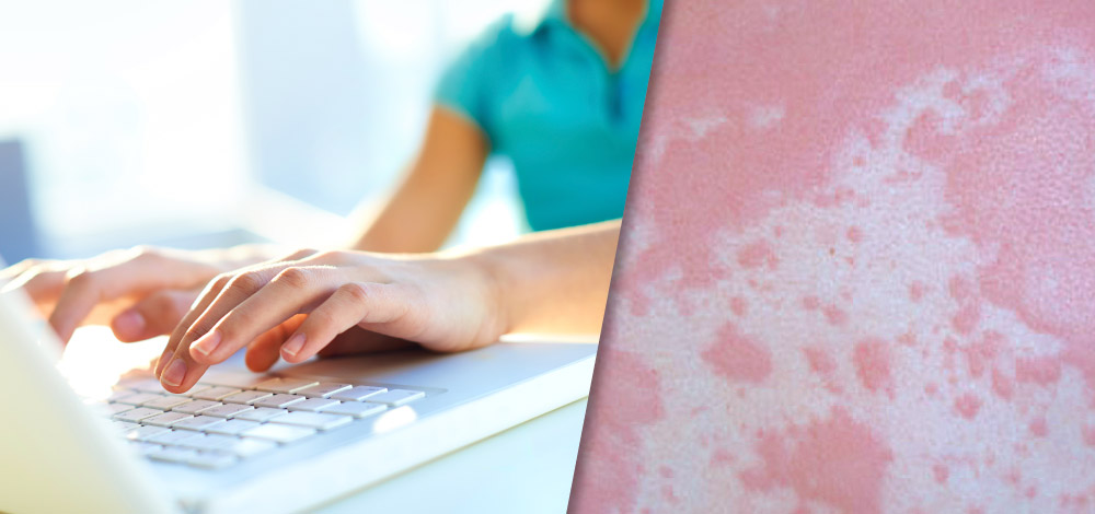 Chronic Urticaria Practice Guidelines