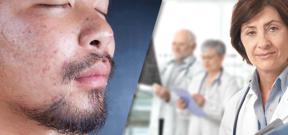 A Clinician’s Guide to Treating Acne