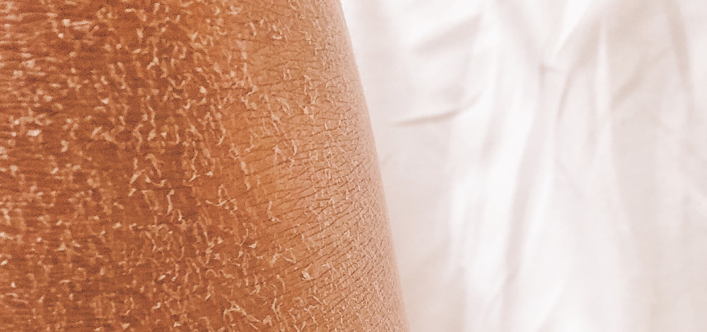 image of dry skin, probably
