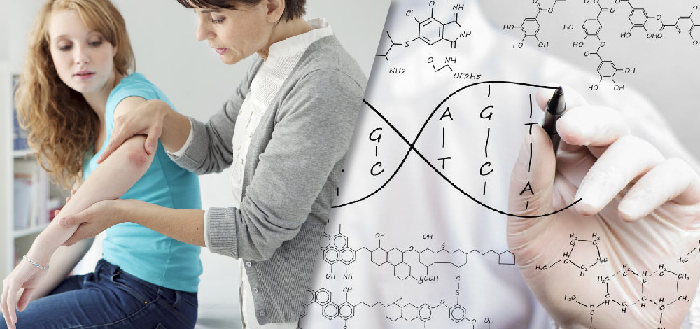 Crisaborole Eucrisa for AtopicDermatitis