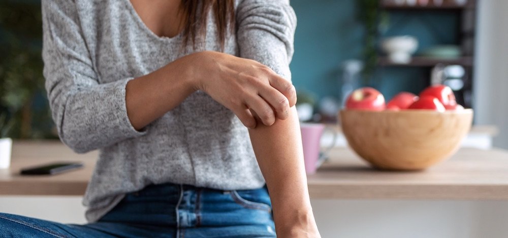 Crisaborole in Atopic Dermatitis
