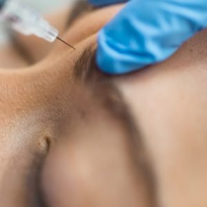 Daxxify injection being done on woman's forehead