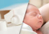 Diacerein Epidermolysis Bullosa Simplex