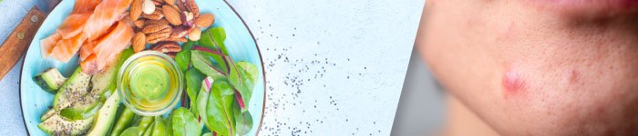 How Diet affects Acne image