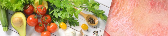 How Diet affects Psoriasis