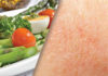 Review of Evidence for Dietary Influences on Atopic Dermatitis
