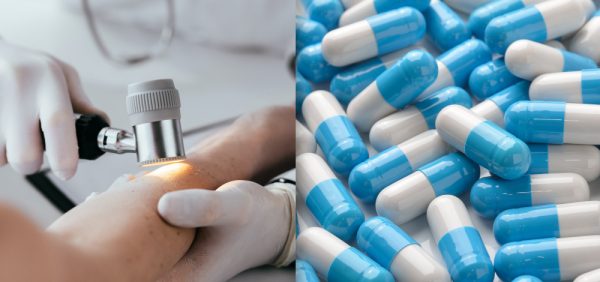 image of pills and dermatologist examining patient's skin