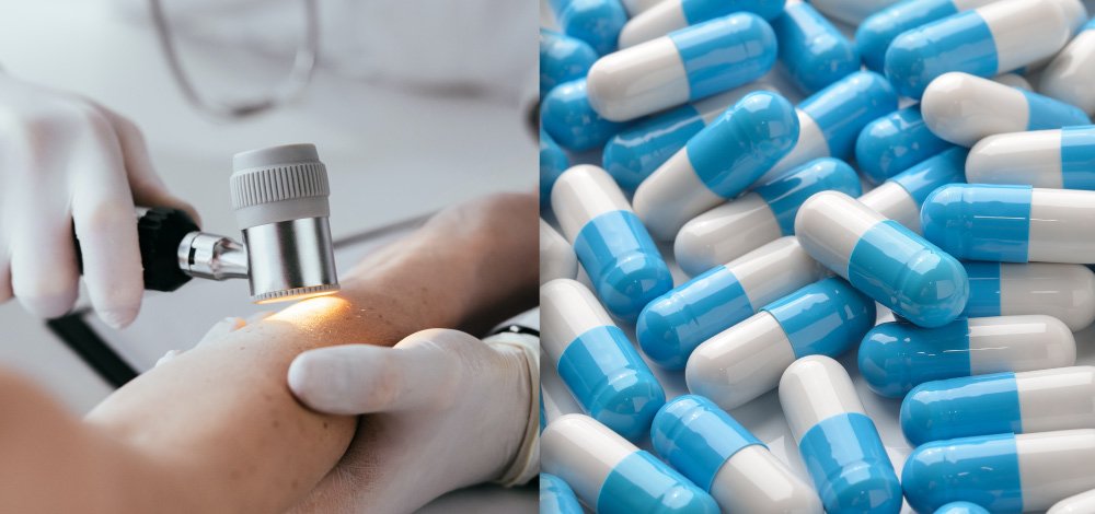 image of pills and dermatologist examining patient's skin