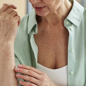 image of an elderly woman checking the skin on her forearm