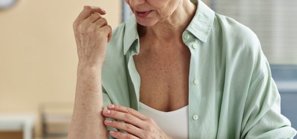 image of an elderly woman checking the skin on her forearm