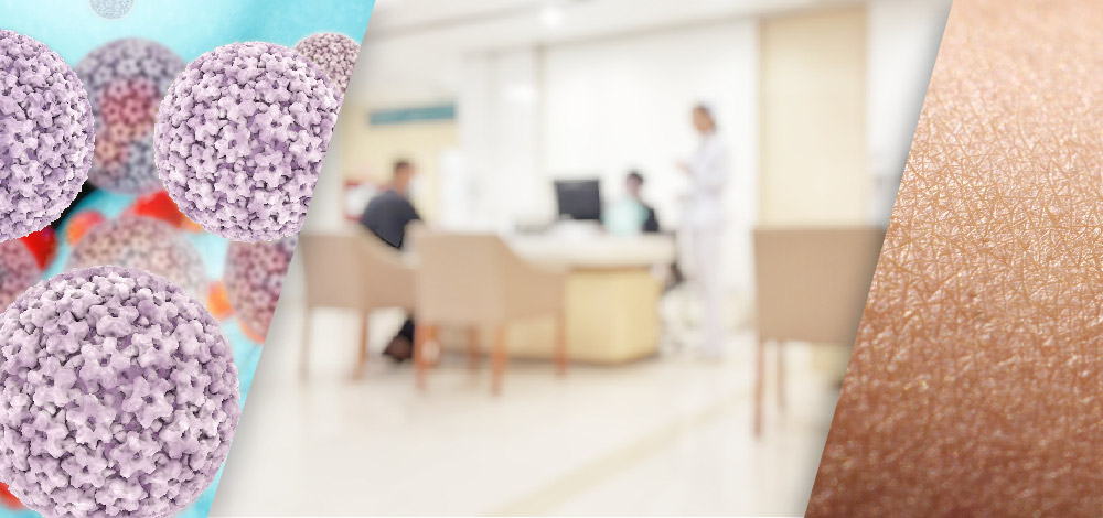 Eumovate (Clobetasone Butyrate) Side Effects, Safety and Risks