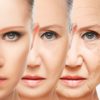 A Comprehensive Guide to FAT GRAFTING