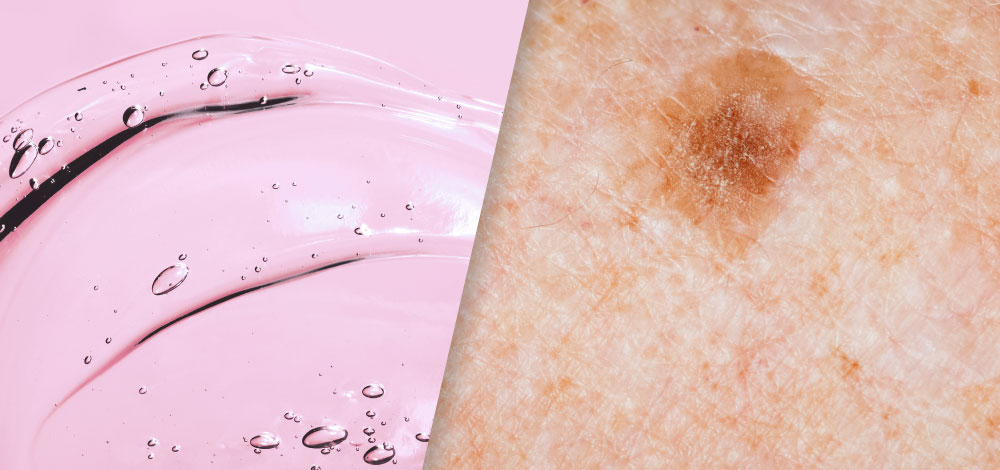 image of skin and cosmetic gel mass