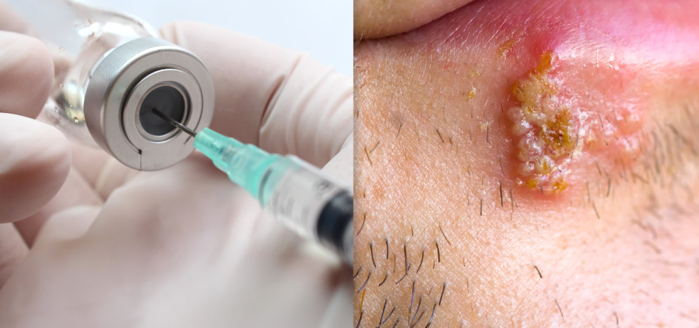 collage image of vaccination and HPV on a lip