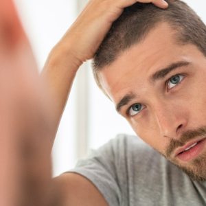 a man with apparent hair loss looking at his reflection in a mirror