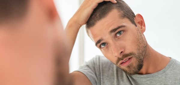 a man with apparent hair loss looking at his reflection in a mirror
