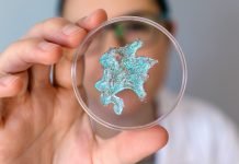 Lebrikizumab concept
