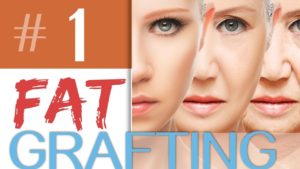 Fat Grafting: What is it?