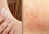 Moisturizers Product Selection