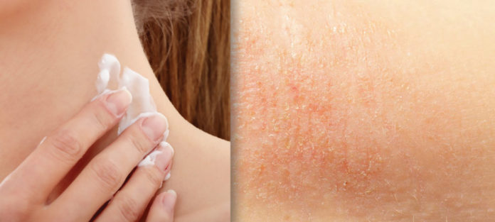 Moisturizers Product Selection