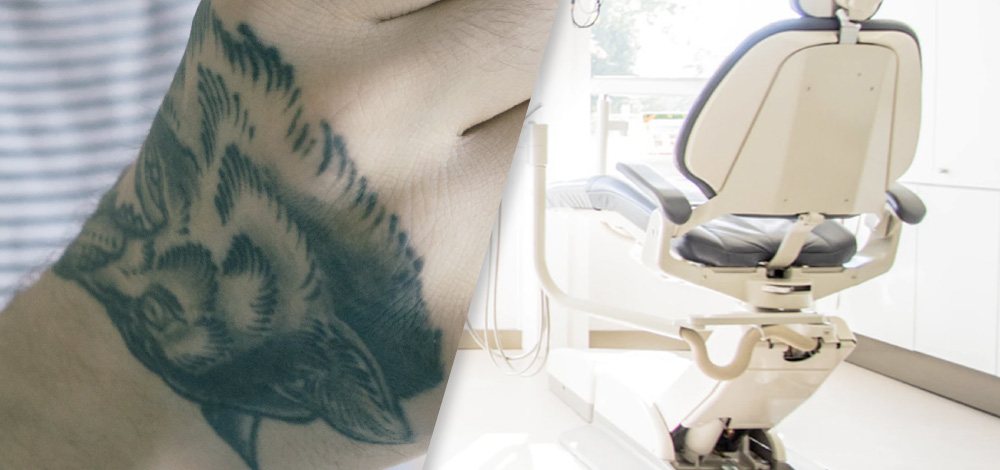 Optimizing Outcomes of Laser Tattoo Removal