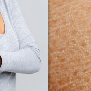 Image collage of woman with itchy skin and skin closeup