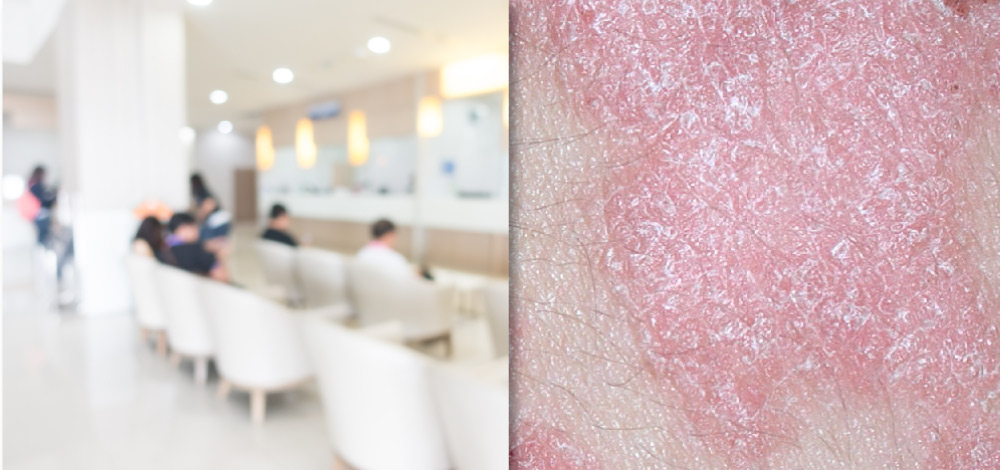 Picture of skin affected by psoriasis and people waiting for treatment in a clinic