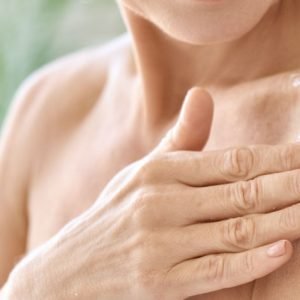 image of woman applying cream on psoriasis patch