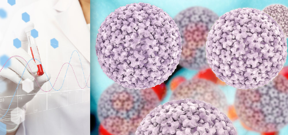 A Review of Fabry Disease