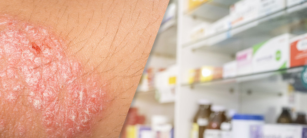 image of woman applying cream on her arm with psoriasis