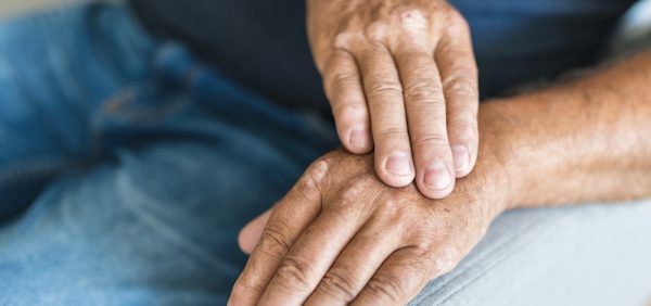 Risankizumab in Adults with Psoriatic Arthritis: image of hands