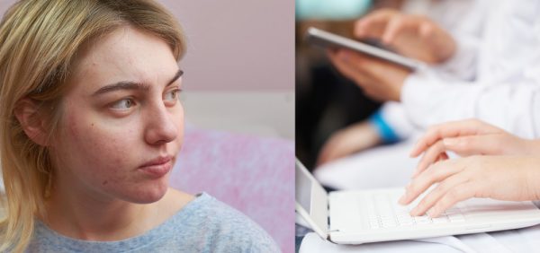 Rosacea: An Update in Diagnosis, Classification and Management
