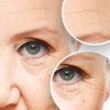 The Science of Facial Aging