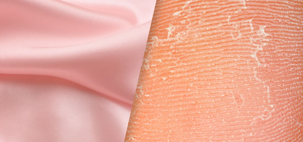 image of Silk Fabrics and dry skin