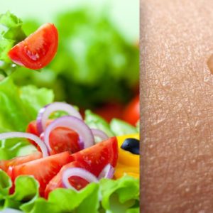 Skin and Diet: An Update on the Role of Dietary Change as a Treatment Strategy for Skin Disease