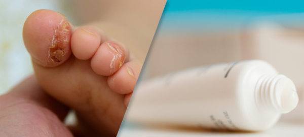 PDF: Use of Topical Crisaborole for Treating Dermatitis in a Variety of Dermatology Settings