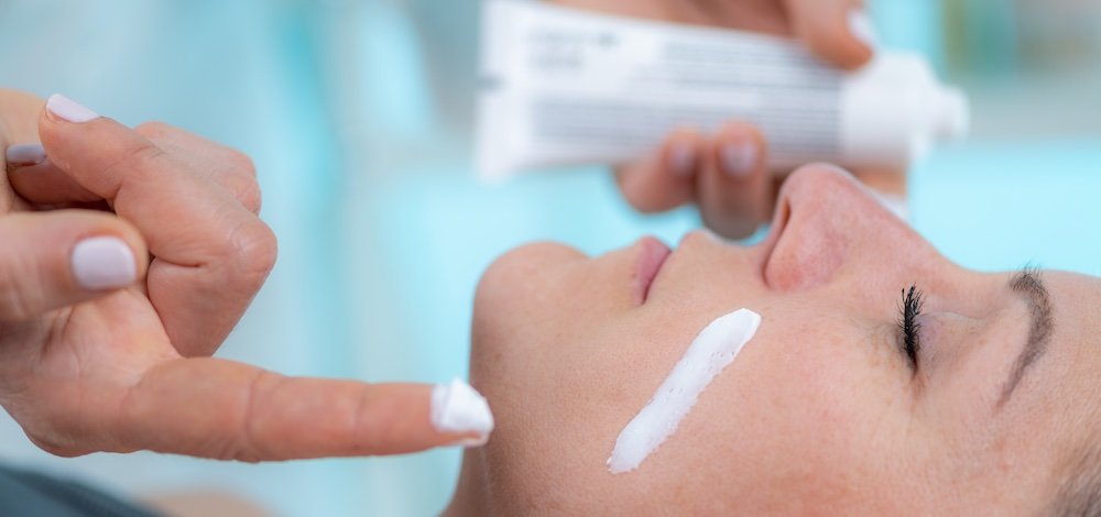 image of Topical Roflumilast Cream applied to patient's face