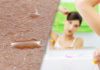 Primary Focal Hyperhidrosis