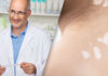 Management Vitiligo