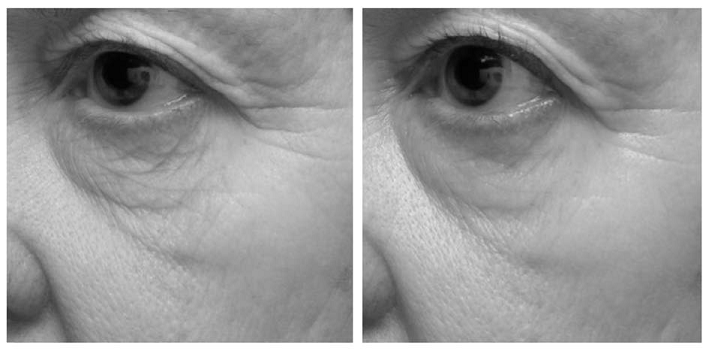 Practical Application of Genomics to the Development of a Topical Cosmetic Anti-aging Regimen - image